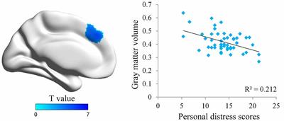 Brain Structural and Functional Substrates of Personal Distress in Empathy